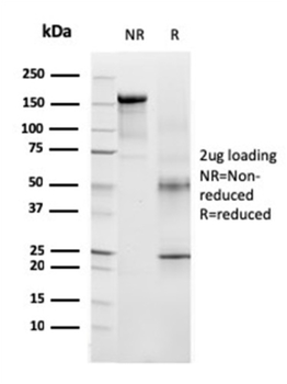 TYRP1 Antibody