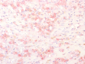 TYRP1 Antibody