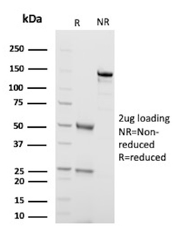 TNFRSF10B Antibody