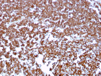 MS4A1 Antibody