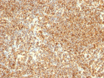 MS4A1 Antibody