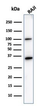 MS4A1 Antibody