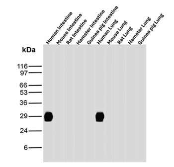 HLA-DPB1 Antibody