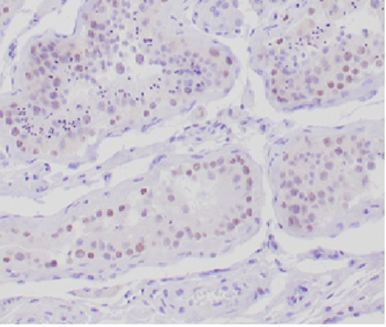 AMH Antibody