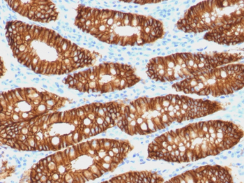 EPCAM Antibody (Biotin)