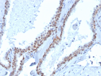 TP63 Antibody (Biotin)