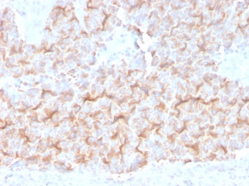 TUBA1B Antibody