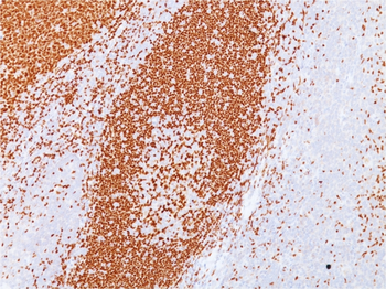 PAX5 Antibody (Biotin)