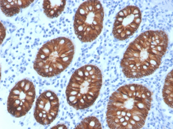 EPCAM Antibody