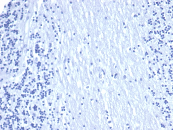 EPCAM Antibody