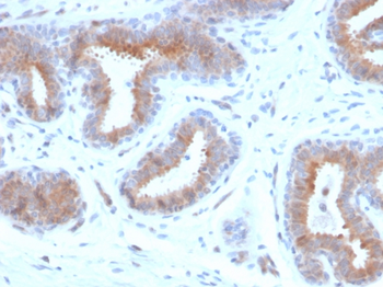 SCGB2A2 Antibody