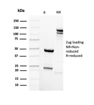 SCGB2A2 Antibody