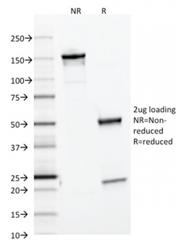 FTL Antibody (Biotin)