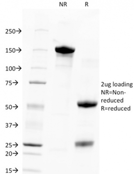 TACSTD2 Antibody (Biotin)