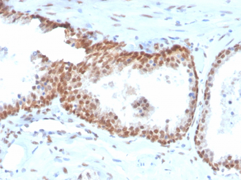 TP63 Antibody (Biotin)