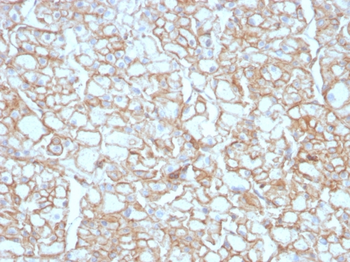 CD274 Antibody