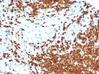 AMH Antibody