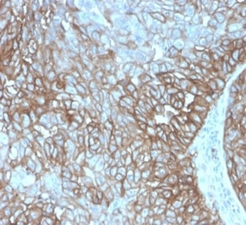 CD274 Antibody