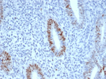 CCNE1 Antibody