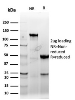 CCNE1 Antibody