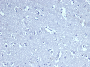 CD8A Antibody