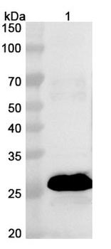 Oropouche virus/OROV Nucleoprotein Rabbit Polyclonal Antibody