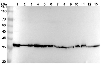 PGAM1 Rabbit Polyclonal Antibody