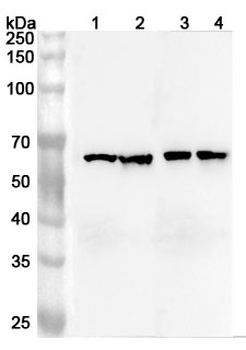 ARFGAP3 Rabbit Polyclonal Antibody