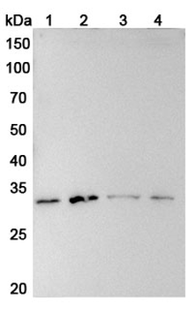 SOCS1 Rabbit Polyclonal Antibody