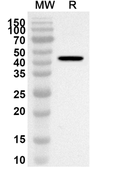 JEV Envelope protein E Rabbit Polyclonal Antibody