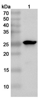 CHPV P/Phosphoprotein Rabbit Polyclonal Antibody