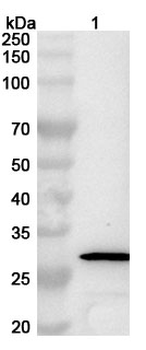 Influenza A virus (H1N1) HA/Hemagglutinin Rabbit Polyclonal Antibody