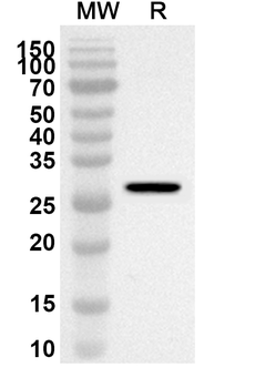 HPV B19 VP2/Coat protein VP2 Rabbit Polyclonal Antibody