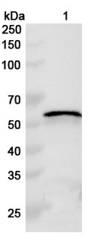 HSV-1/HHV-1 TRX1/UL38 Rabbit Polyclonal Antibody