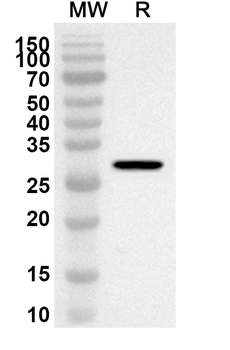 BVDV E(rns)/gp44/48 Rabbit Polyclonal Antibody