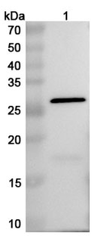 BVDV E(rns)/gp44/48 Rabbit Polyclonal Antibody