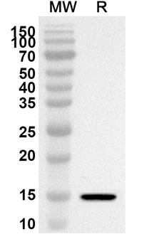 HIV-2 env/Env polyprotein/gp36 Rabbit Polyclonal Antibody