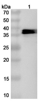 HAdV-5 E1B-55K Rabbit Polyclonal Antibody