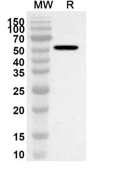 BCCV Gc/Glycoprotein C Rabbit Polyclonal Antibody
