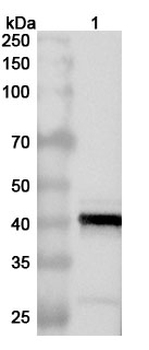 ASFV CP2475L (p37) Rabbit Polyclonal Antibody