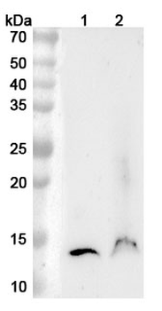 TFF2 Rabbit Polyclonal Antibody