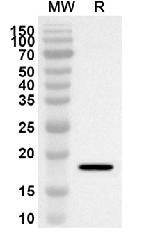 AHSA1 Rabbit Polyclonal Antibody