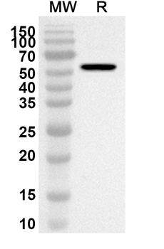 TADA2A Rabbit Polyclonal Antibody