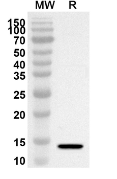TSPAN1 Rabbit Polyclonal Antibody
