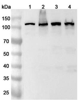 SART1 Rabbit Polyclonal Antibody