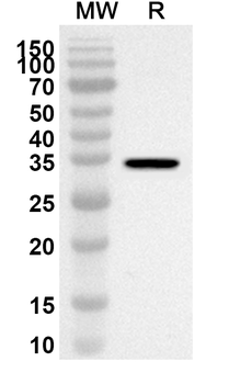 ENC1 Rabbit Polyclonal Antibody
