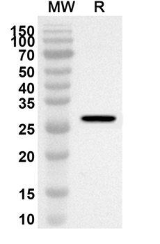 AQP7 Rabbit Polyclonal Antibody