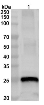 RABV M/Matrix protein Rabbit Polyclonal Antibody
