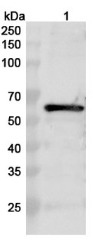 RABV NP/Nucleoprotein Rabbit Polyclonal Antibody