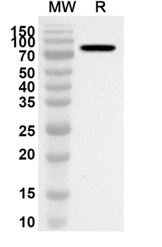 ADARB1 Rabbit Polyclonal Antibody